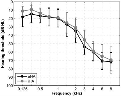 Exploring Differences in Speech Processing Among Older Hearing-Impaired Listeners With or Without Hearing Aid Experience: Eye-Tracking and fMRI Measurements